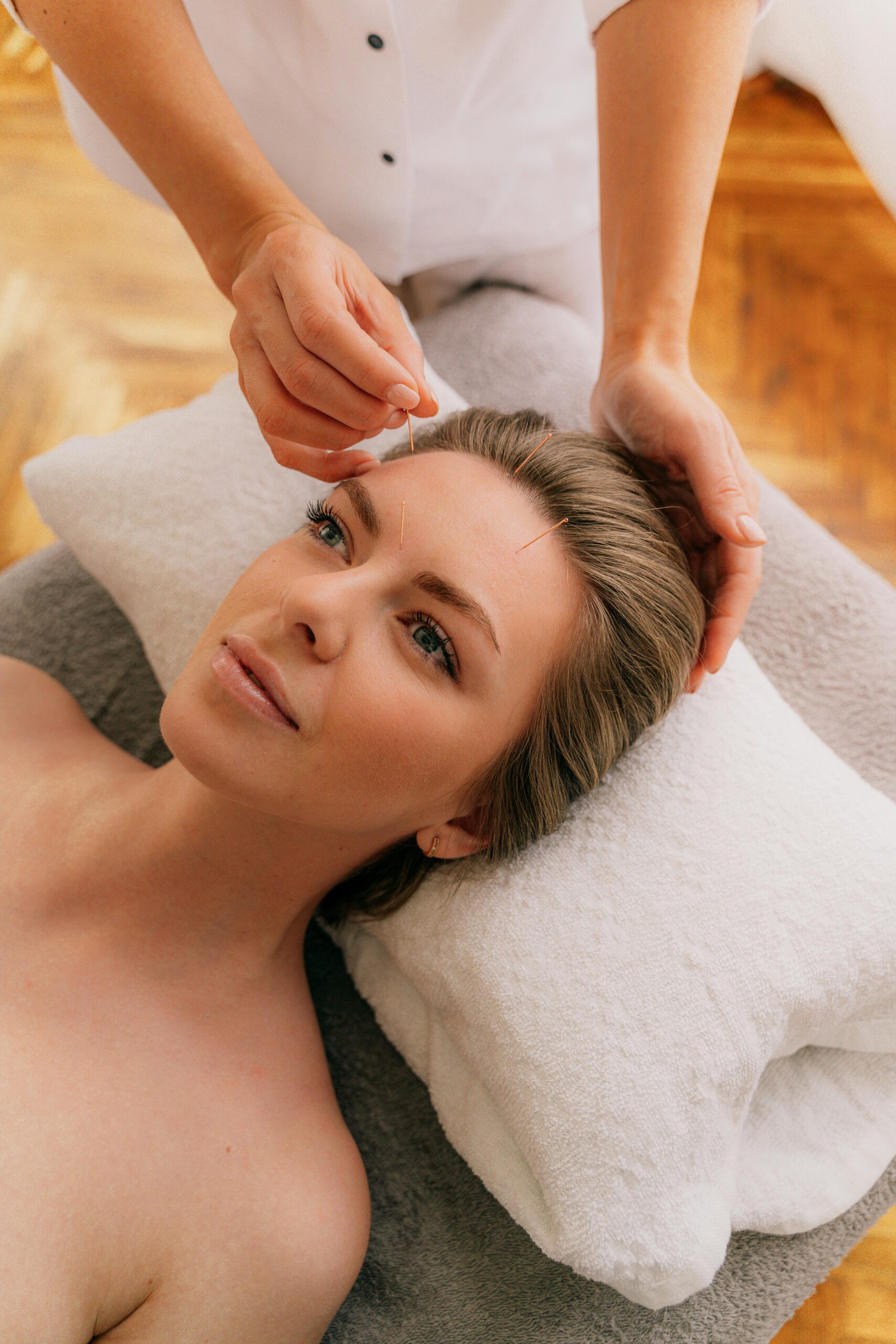 Lifting visage acupuncture Perpignan – cure anti-âge progressive et personnalisée