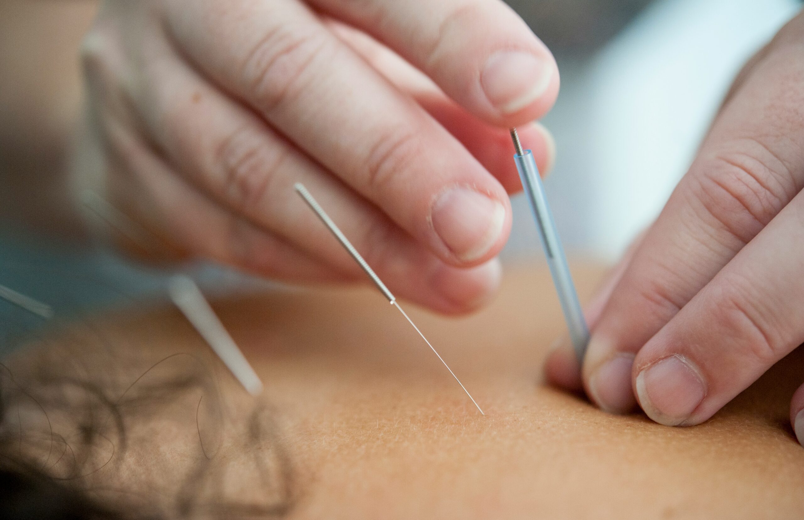 Séance de Médecine Traditionnelle Chinoise Perpignan avec bilan énergétique complet
